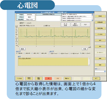 心電図